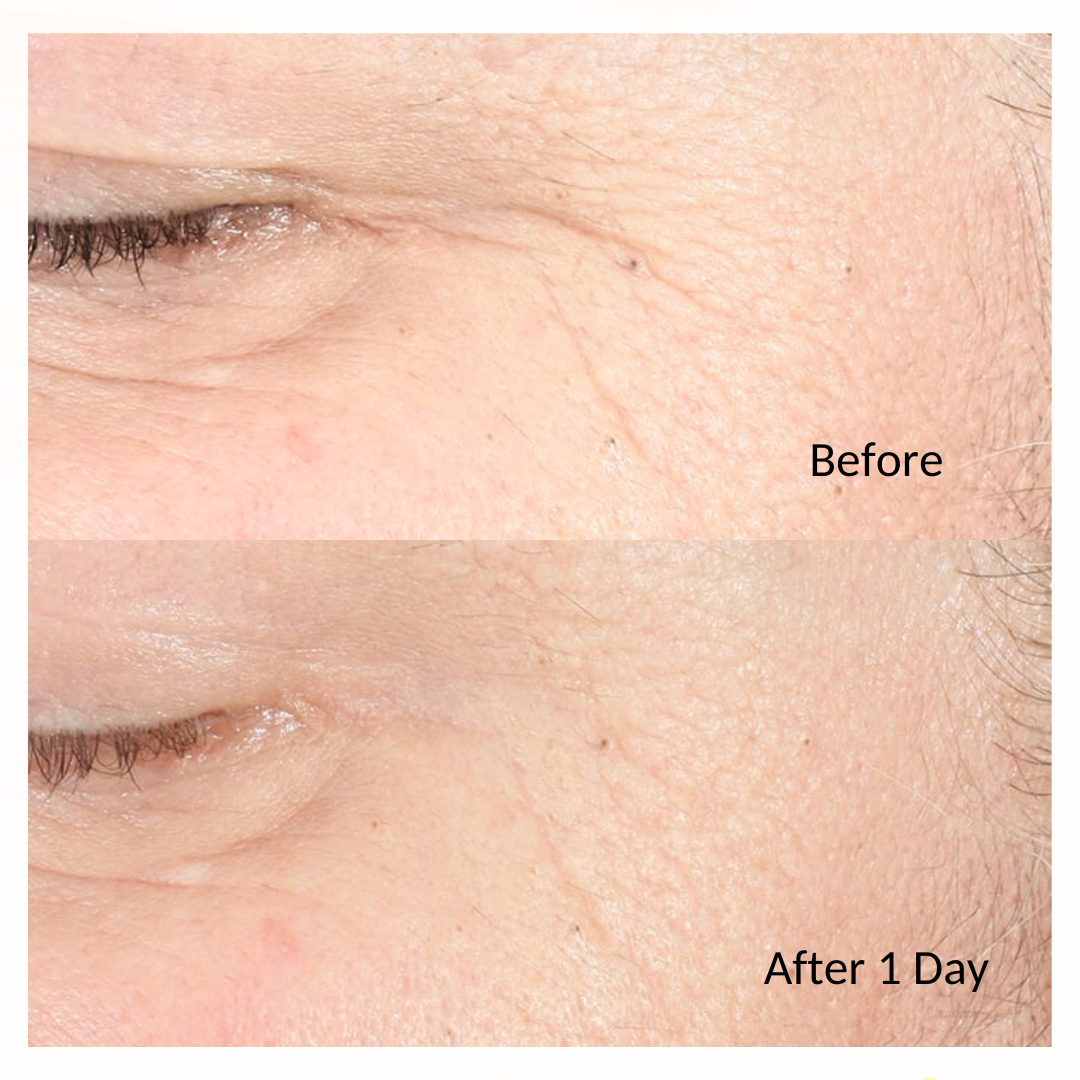 iS Clinical Youth Intensive Creme