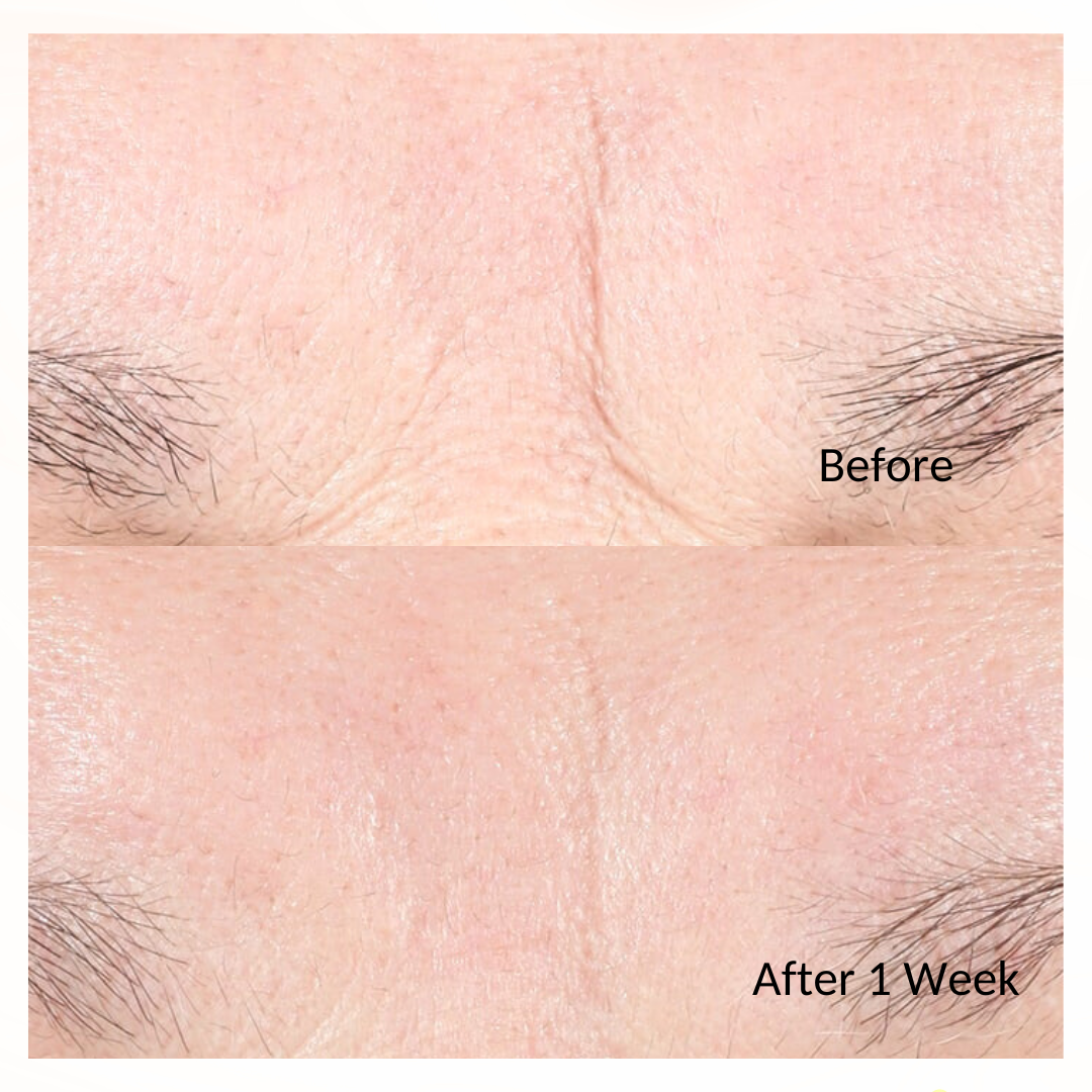 iS Clinical Youth Intensive Creme