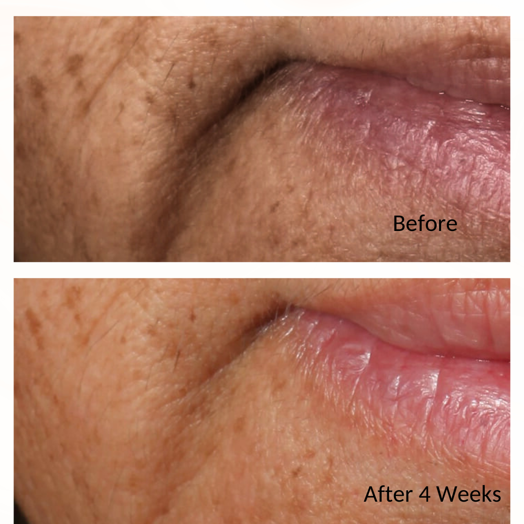 iS Clinical Youth Intensive Creme