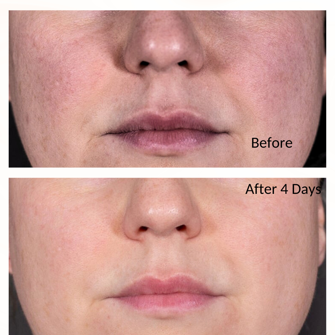 iS Clinical Retinol + Emulsion 0.3