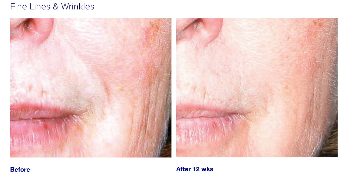 iS Clinical Active Serum