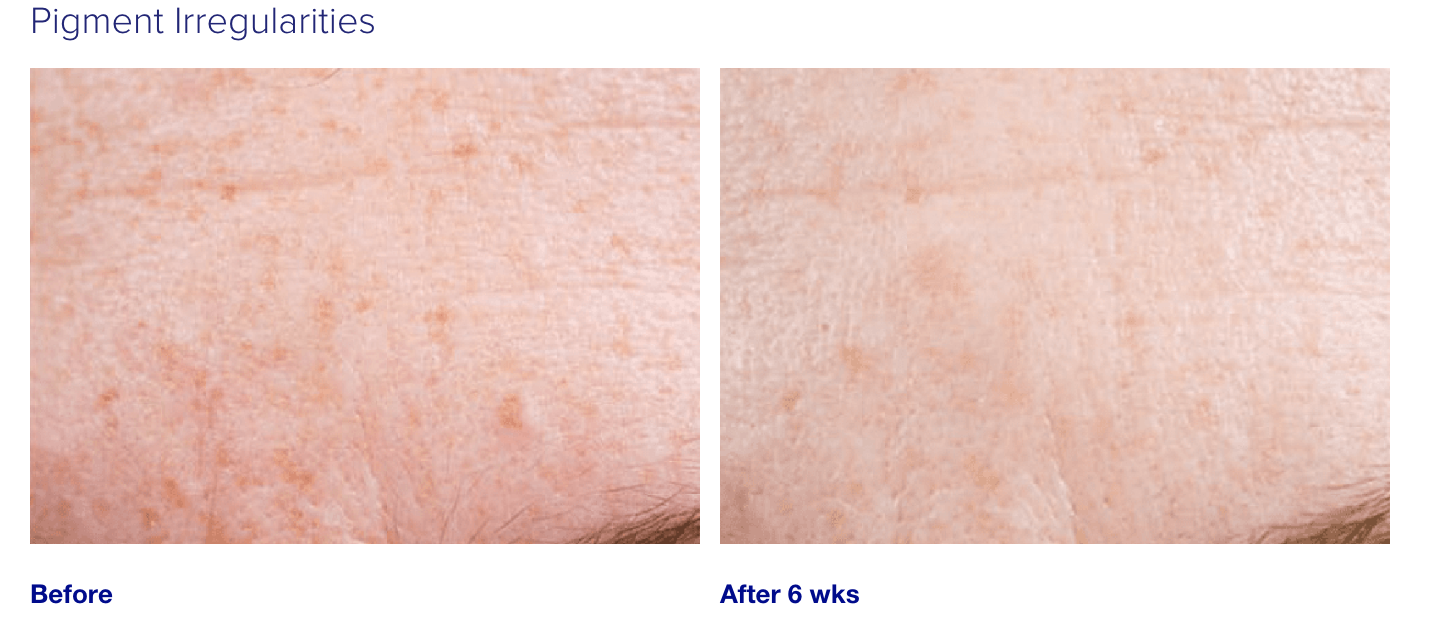 iS Clinical Active Serum