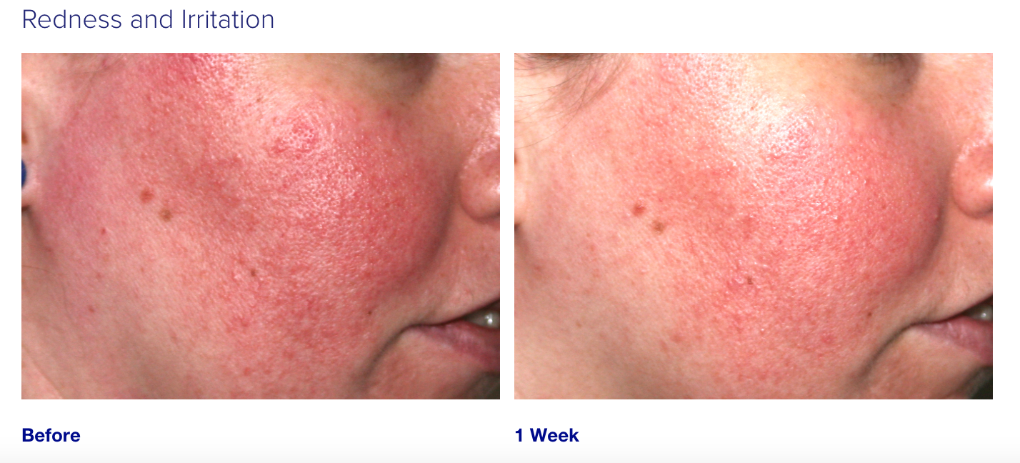iS Clinical Pro-Heal Serum Advance+