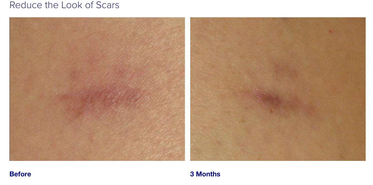 iS Clinical Super Serum Advance+ (15ML)