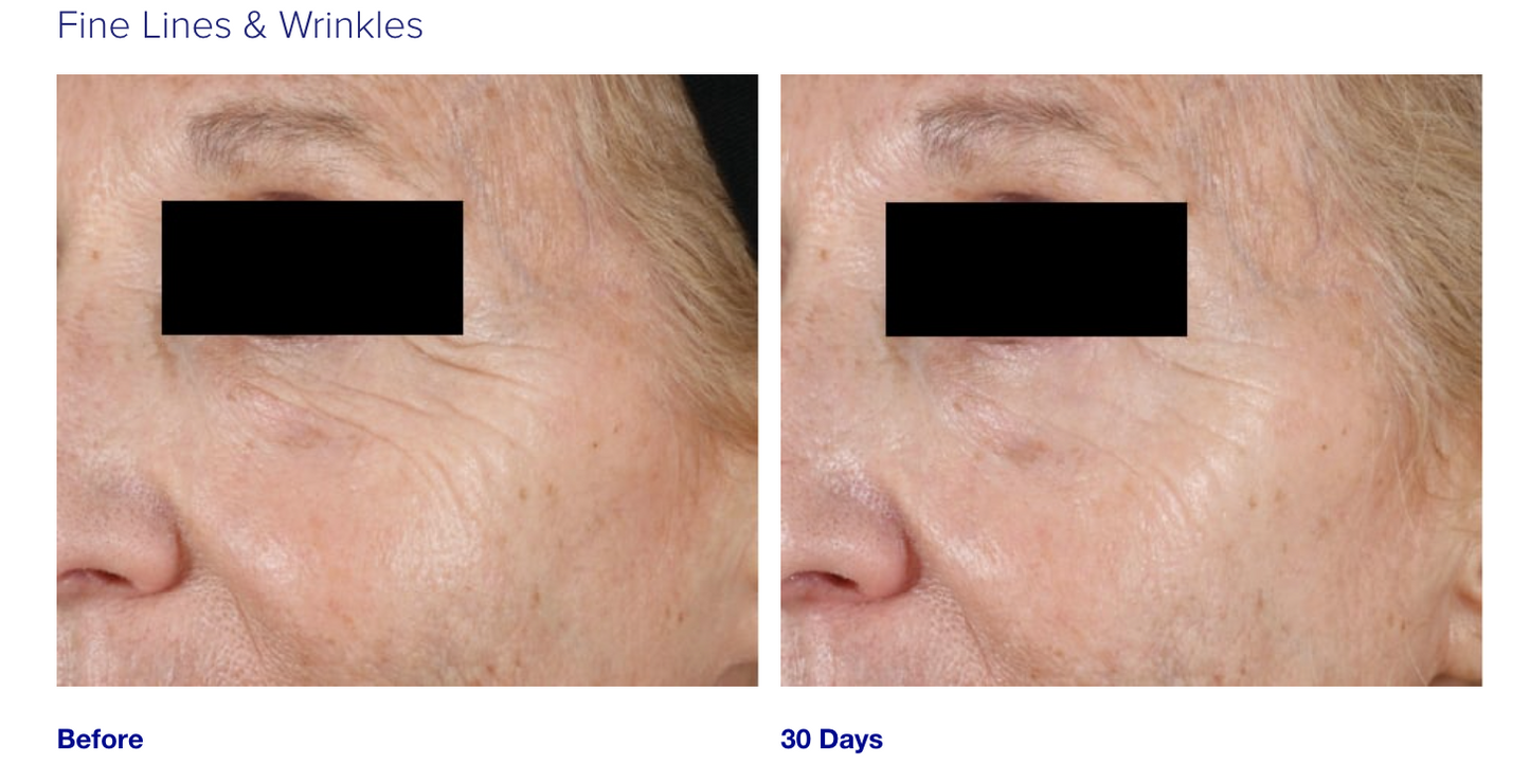 iS Clinical Youth Eye Complex