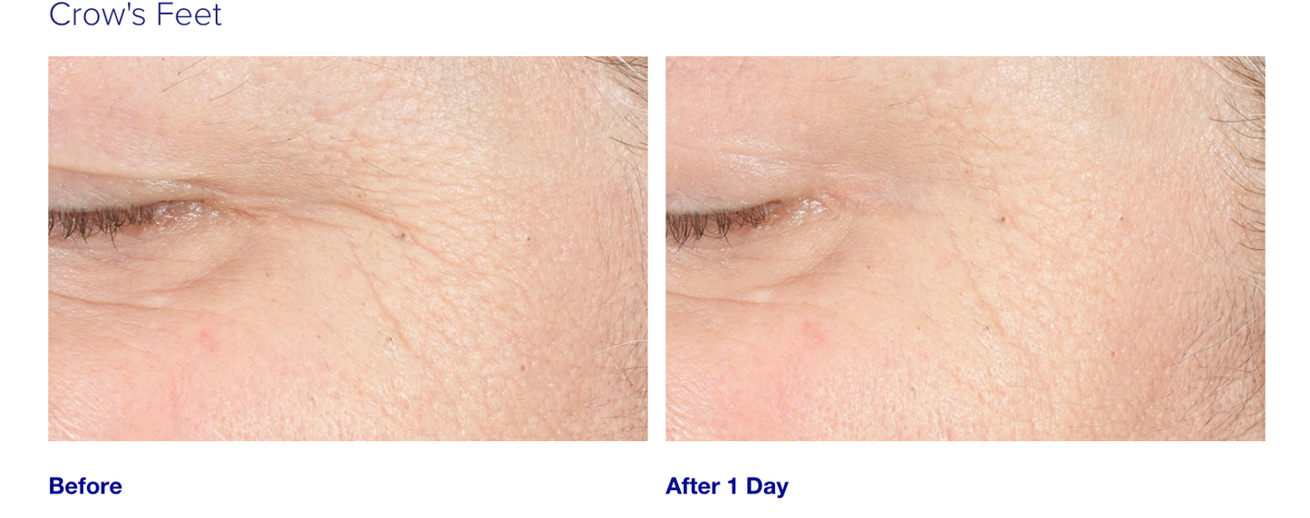 iS Clinical Youth Intensive Creme