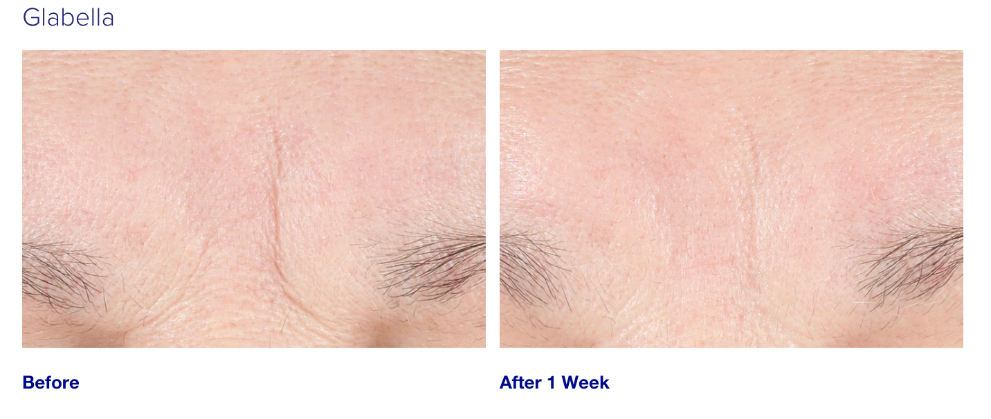 iS Clinical Youth Intensive Creme