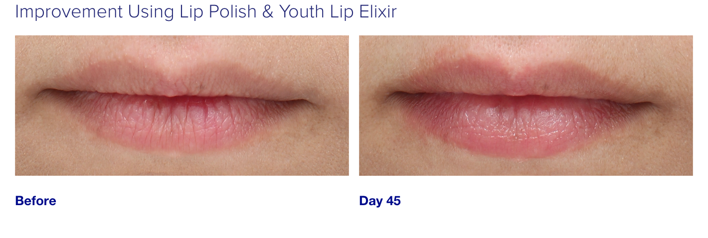 iS Clinical Youth Lip Elixir