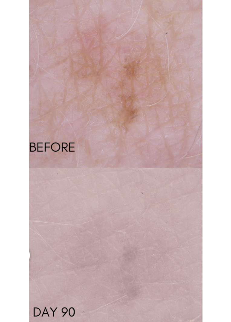 iS Clinical Brightening Serum
