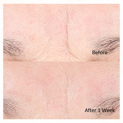 iS Clinical Youth Intensive Creme
