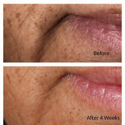 iS Clinical Youth Intensive Creme