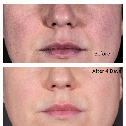 iS Clinical Retinol+ Emulsion 0.3