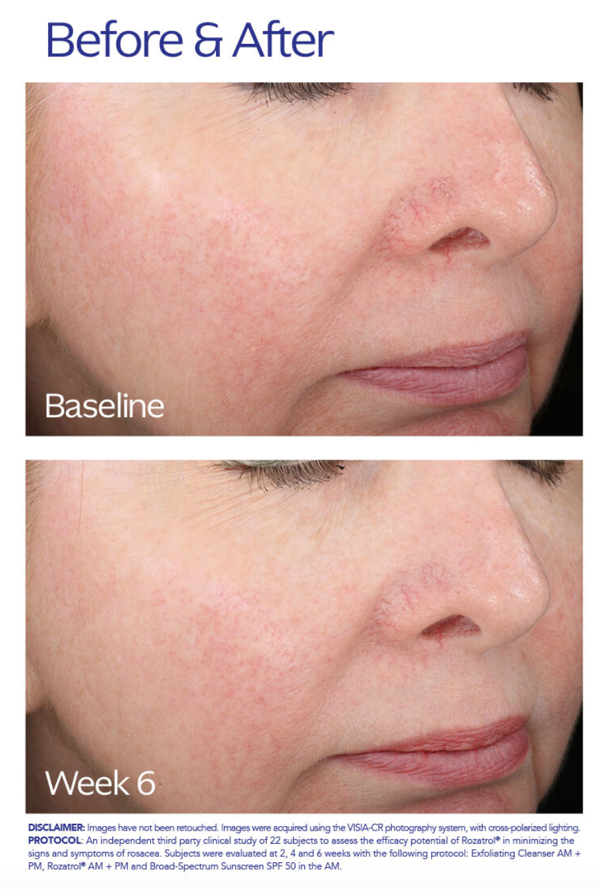 ZO Skin Health Rozatrol®