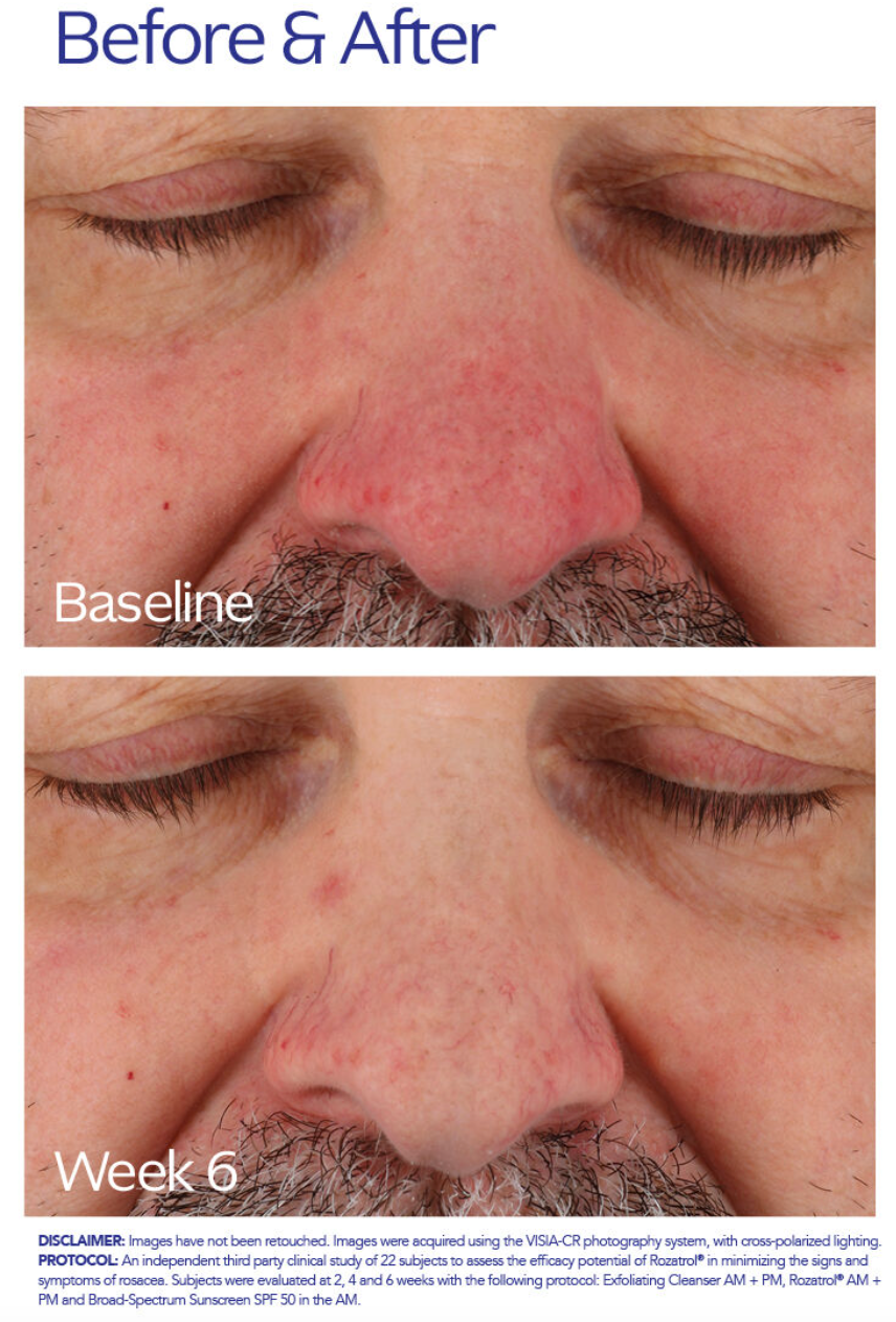 ZO Skin Health Rozatrol®