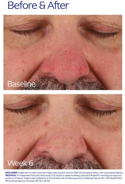 ZO Skin Health Rozatrol®