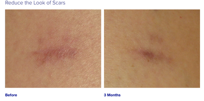 iS Clinical Super Serum Advance+ (15ML)