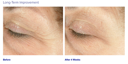 iS Clinical Youth Complex