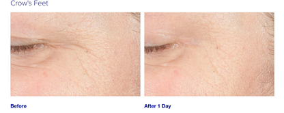 iS Clinical Youth Intensive Creme