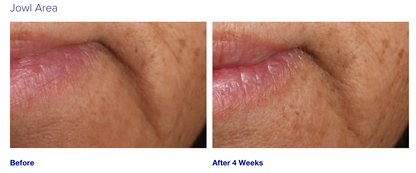 iS Clinical Youth Intensive Creme